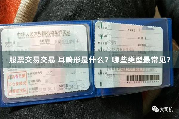 股票交易交易 耳畸形是什么？哪些类型最常见？